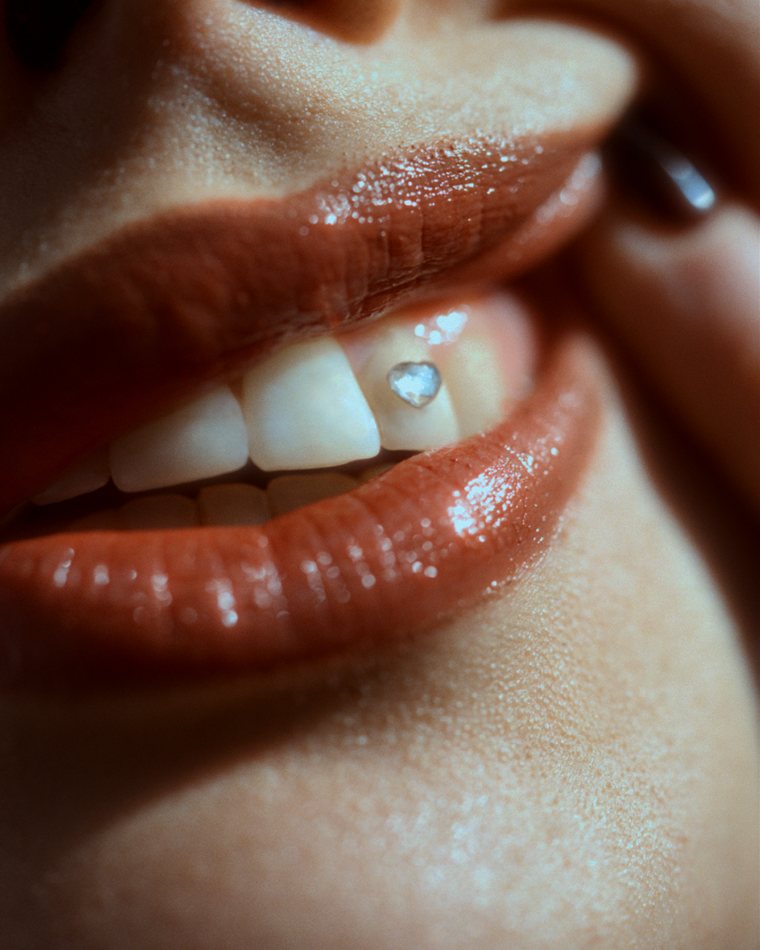 Tooth Gem İstanbul - Tooth Gems Turkey